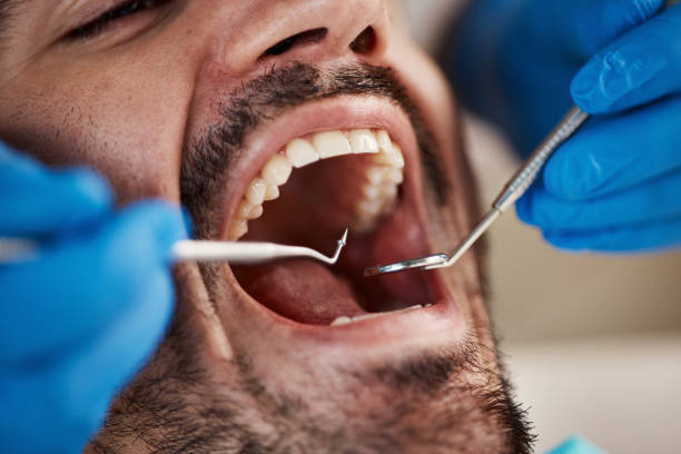 Best Dentist for Tooth Abscess  in Owens Cross Roads, AL